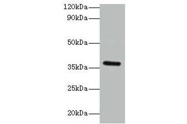 BRCC3 抗体  (AA 14-316)