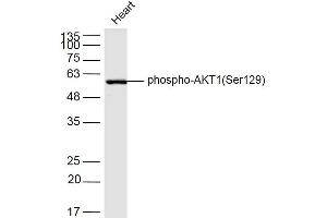 Mouse heart lysates probed with AKT1(Ser129) Polyclonal Antibody, Unconjugated  at 1:300 dilution and 4˚C overnight incubation. (AKT1 antibody  (pSer129))