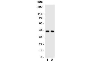 Western blot testing of CXCR5 antibody and Lane 1:  rat spleen;  2: human HeLa cell lysate.