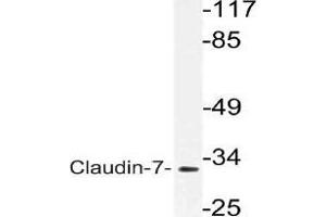 Western blot (WB) analysis of VDR antibody in extracts from rat liver cells. (Claudin 7 antibody)