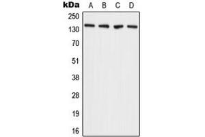 Western blot analysis of ADAMTS2 expression in A431 (A), MCF7 (B), SP2/0 (C), H9C2 (D) whole cell lysates. (Adamts2 antibody  (C-Term))