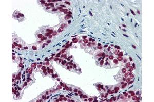 Anti-SP1 antibody IHC of human prostate. (SP1 antibody  (AA 89-199))