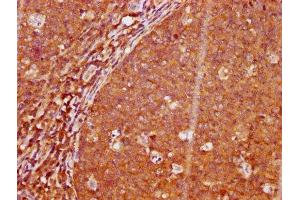 Immunohistochemistry (IHC) image for anti-Linker For Activation of T Cells (LAT) (pTyr191) antibody (ABIN7127705)