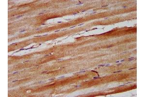 IHC image of ABIN7161101 diluted at 1:600 and staining in paraffin-embedded human skeletal muscle tissue performed on a Leica BondTM system.