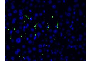 ABIN6267554 at 1/200 staining human gastric tissue sections by ICC/IF. (LIM Domain Kinase 1 antibody  (pThr508))
