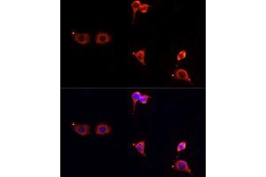 Immunofluorescence analysis of PC12 cells using MTOR antibody. (MTOR antibody  (AA 2388-2487))