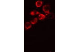 ABIN6266687 staining MCF-7 cells by IF/ICC. (DLGAP1 antibody  (Internal Region))