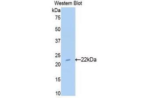 Western Blotting (WB) image for anti-Sulfite Oxidase (SUOX) (AA 89-270) antibody (ABIN1176602) (SUOX antibody  (AA 89-270))