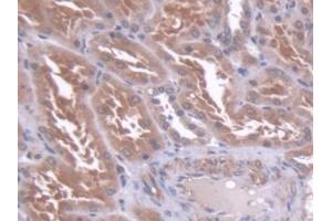 Detection of CBFb in Human Kidney Tissue using Polyclonal Antibody to Core Binding Factor Beta Subunit (CBFb) (CBFB antibody  (AA 1-182))