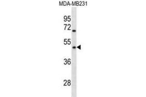 Western Blotting (WB) image for anti-Olfactory Receptor 1Q1 (OR1Q1) antibody (ABIN3000764)