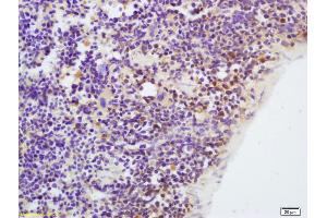 Formalin-fixed and paraffin embedded mouse spleen labeled with Anti-CKLF Polyclonal Antibody, Unconjugated (ABIN739650) at 1:200, followed by conjugation to the secondary antibody and DAB staining (CKLF antibody  (AA 1-100))