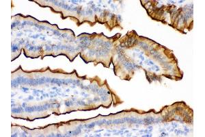 Anti- Villin Picoband antibody,IHC(P) IHC(P): Mouse Intestine Tissue (Villin 1 antibody  (C-Term))