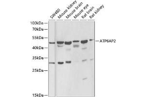 Western blot analysis of extracts of various cell lines, using  antibody (ABIN6129200, ABIN6137342, ABIN6137343 and ABIN6222191) at 1:1000 dilution. (ATP6AP2 antibody  (AA 251-350))