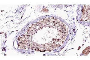 ABIN6275326 at 1/100 staining human testis tissue sections by IHC-P.