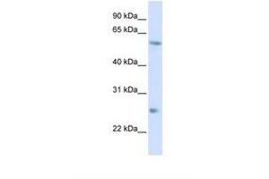 Image no. 1 for anti-Ceramide Synthase 2 (CERS2) (AA 51-100) antibody (ABIN6737661) (Ceramide Synthase 2 antibody  (AA 51-100))