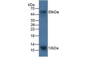 Figure. (S100A14 antibody  (AA 1-91))