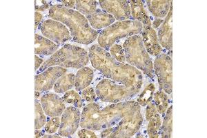 Immunohistochemistry of paraffin-embedded mouse kidney using FKBP6 antibody. (FKBP6 antibody  (AA 1-327))