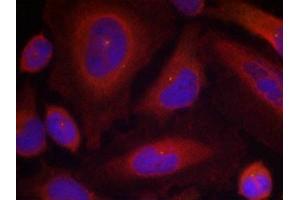 Immunofluorescence staining of methanol-fixed Hela cells using Synaptotagmin 1 (Phospho-Ser309) Antibody. (SYT1 antibody  (pSer309))