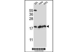 Western blot analysis in 293,Hela,K562 cell line lysates (35ug/lane). (DHFRL1 antibody  (AA 45-74))
