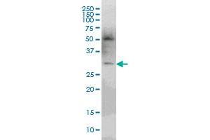 PLEKHO2 anticorps  (AA 392-490)
