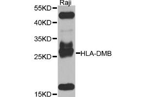Western blot analysis of extracts of Raji cells, using HLA-DMB antibody. (HLA-DMB antibody)