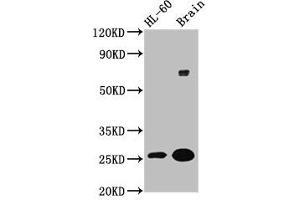 Western Blot Positive WB detected in: HL60 whole cell lysate, Rat brain tissue All lanes: FEV antibody at 5.