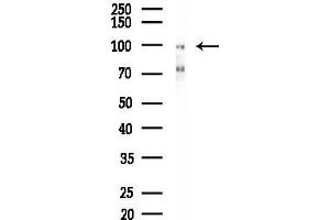 Western blot analysis of lysates from Mouse liver, using HGS Antibody at 1/1000 dilution.