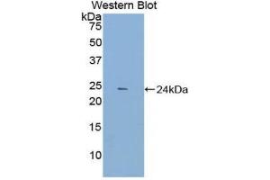 Western Blotting (WB) image for anti-Dynamin 1 (DNM1) (AA 572-745) antibody (ABIN1858658) (Dynamin 1 antibody  (AA 572-745))