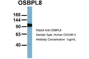 Host:  Rabbit  Target Name:  OSBPL8  Sample Type:  OVCAR-3  Antibody Dilution:  1. (OSBPL8 antibody  (Middle Region))