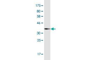 Western Blot detection against Immunogen (36. (POTEH antibody  (AA 189-288))