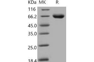 Western Blotting (WB) image for Kin of IRRE Like 1 (NEPH1) (Active) protein (His tag) (ABIN7320373) (KIRREL Protein (His tag))