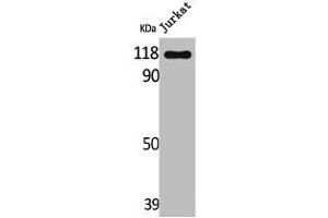 Western Blot analysis of Jurkat cells using Lfc Polyclonal Antibody (ARHGEF2 antibody)