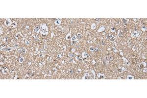 Immunohistochemistry of paraffin-embedded Human brain tissue using WIF1 Polyclonal Antibody at dilution of 1:100(x200) (WIF1 antibody)