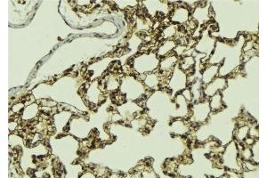 ABIN6268983 at 1/100 staining Mouse lung tissue by IHC-P. (ATRIP antibody  (pSer224))