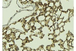 ABIN6268983 at 1/100 staining Mouse lung tissue by IHC-P.