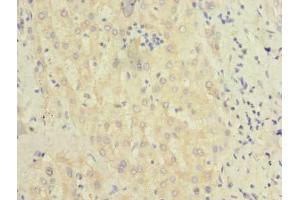 Immunohistochemistry of paraffin-embedded human liver tissue using ABIN7145347 at dilution of 1:100 (BEND7 antibody  (AA 1-374))