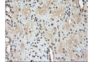 Image no. 3 for anti-TYRO3 Protein Tyrosine Kinase (TYRO3) antibody (ABIN1501608)