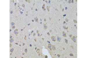 Immunohistochemistry of paraffin-embedded Mouse brain using ITGB8 Polyclonal Antibody at dilution of 1:100 (40x lens). (ITGB8 antibody)