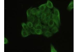 Detection of TUBb in Human MCF7 Cell using Polyclonal Antibody to Tubulin Beta (TUBb) (TUBB antibody  (AA 170-419))