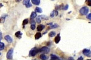 Immunohistochemistry analysis of paraffin-embedded rat lung using,CD63 (ABIN7073400) at dilution of 1: 750 (CD63 antibody)