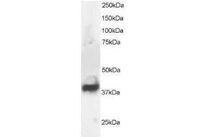 Image no. 1 for anti-Septin 3 (SEPT3) (N-Term) antibody (ABIN374202) (Septin 3 antibody  (N-Term))