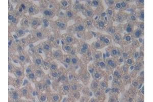 Detection of PDHX in Mouse Liver Tissue using Polyclonal Antibody to Pyruvate Dehydrogenase Complex Component X (PDHX)