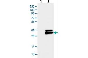 Western blot analysis of Lane 1: Negative control (vector only transfected HEK293T lysate), Lane 2: Over-expression Lysate (Co-expressed with a C-terminal myc-DDK tag (~3. (TMEM176A antibody)