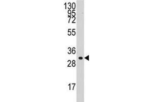 Western blot analysis of Cyclin C antibody and HL-60 lysate. (Cyclin C antibody  (AA 221-249))