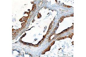 IHC analysis of SEC22B using anti-SEC22B antibody (ABIN7602121). (SEC22B antibody  (AA 6-197))