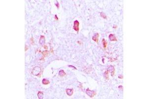Immunohistochemical analysis of CDC37 staining in human brain formalin fixed paraffin embedded tissue section. (CDC37 antibody  (Center))