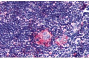 Anti-LPAR6 / P2RY5 antibody  ABIN1049020 IHC staining of human thymus. (LPAR6 antibody  (Extracellular Domain))