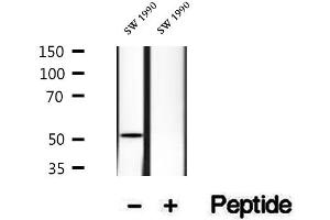 HERPUD1 antibody  (N-Term)