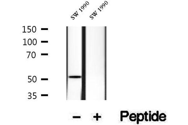 HERPUD1 antibody  (N-Term)