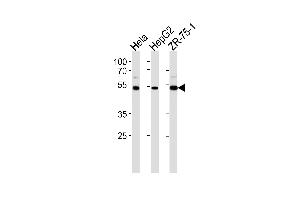 Western blot analysis in Hela,HepG2,ZR-75-1 cell line lysates (35ug/lane).